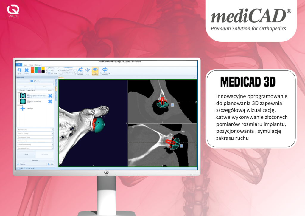 Medicad str2